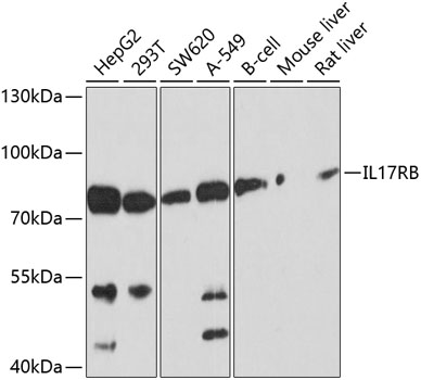 Anti-IL-17RB Antibody (CAB10147)