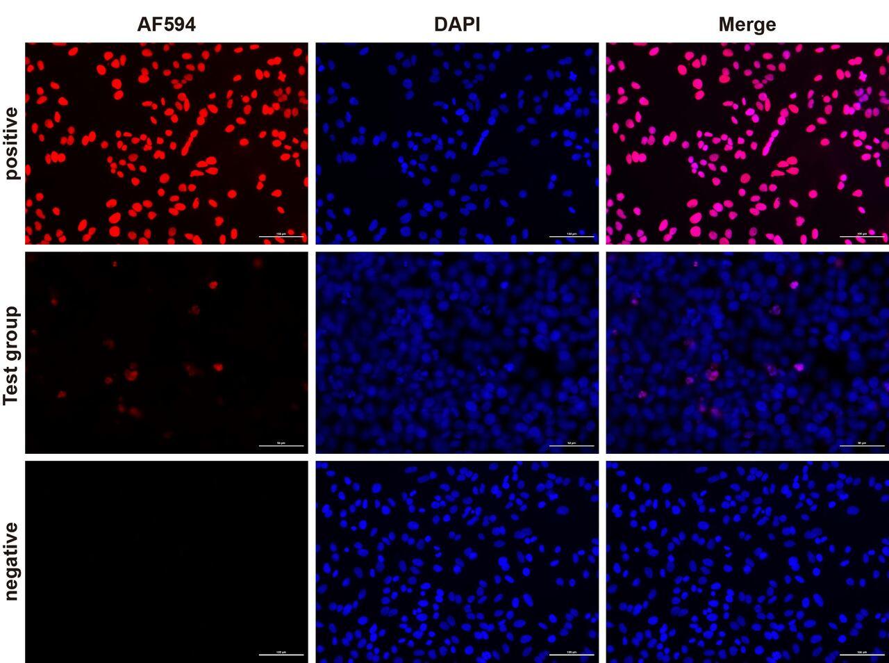 Fluorescence microscope analysis of camptothecin-induced apoptosis of Hela cells.