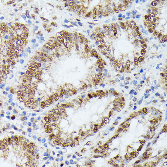 Anti-KIF22 Antibody (CAB15285)