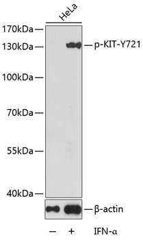 Anti-Phospho-KIT-Y721 Antibody (CABP0385)