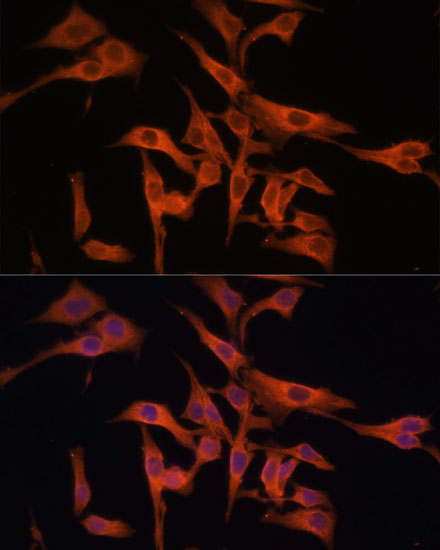 Anti-LGMN Antibody (CAB10570)