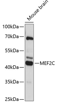 Anti-MEF2C Antibody (CAB12385)