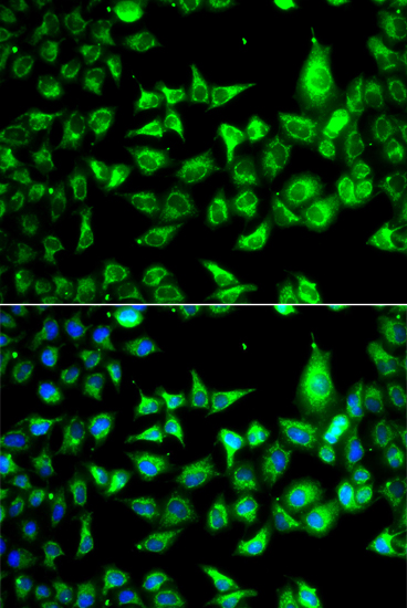 Anti-ACCS Antibody (CAB13441)