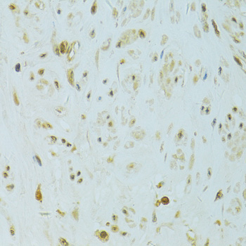 Anti-XBP1 Antibody (CAB14651)