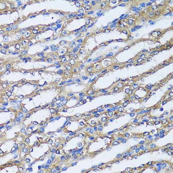 Anti-NQO2 Antibody (CAB11746)