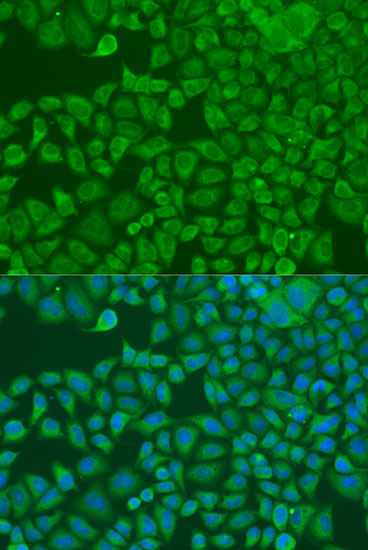 Anti-FXR2 Antibody (CAB4313)