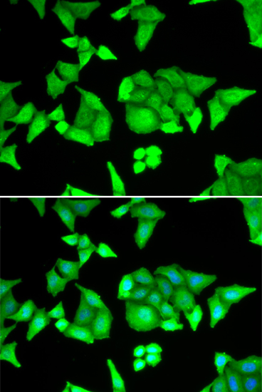 Anti-TRIM27 Antibody (CAB6405)