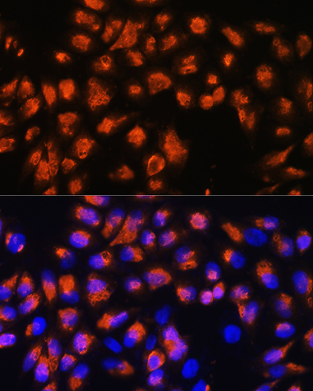 Anti-AGRN Antibody (CAB17320)