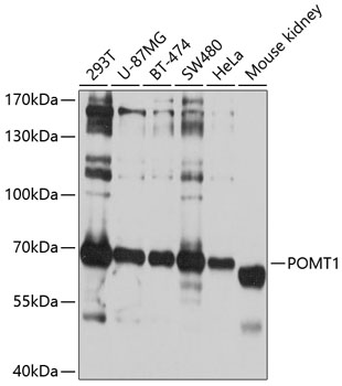 Anti-POMT1 Antibody (CAB10281)