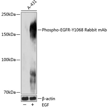 Anti-Phospho-EGFR-Y1068 Antibody (CABP0027)