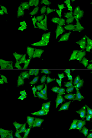 Anti-AGA Antibody (CAB13942)