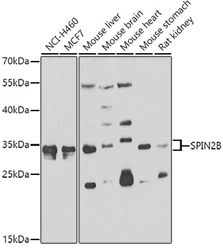 Anti-SPIN2B Antibody (CAB7407)