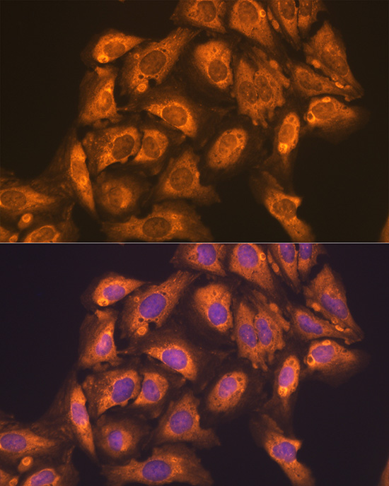 Anti-CD47 Antibody (CAB1838)