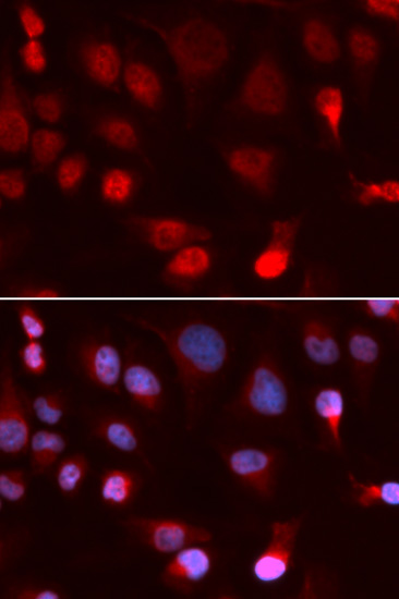 Anti-ATP7B Antibody (CAB5676)