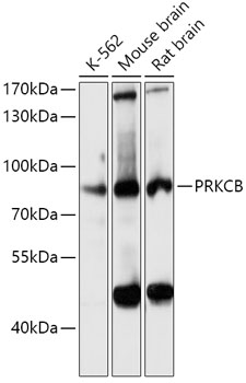 Anti-PRKCB Antibody (CAB5845)