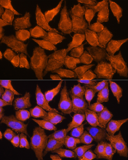 Anti-AOX1 Antibody (CAB3586)