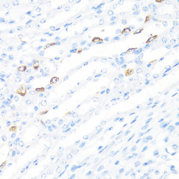 Anti-FGF10 Antibody (CAB1201)