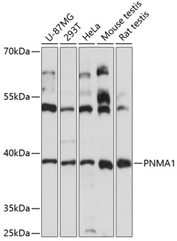 Anti-PNMA1 Antibody (CAB14558)
