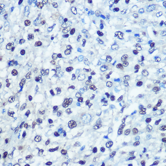 Anti-SAMHD1 Antibody [KO Validated] (CAB7794)