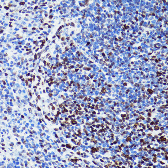 Anti-Acetyl-Histone H2B-K5 Antibody (CAB15621)