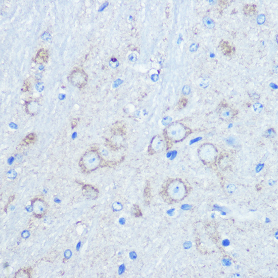 Anti-LC3B Antibody (CAB5601)