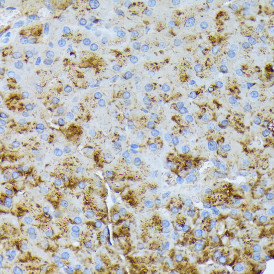 Anti-CTRB1 Antibody (CAB15043)