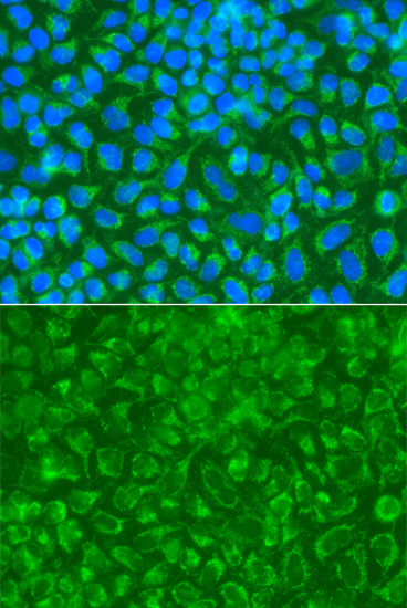 Anti-STRN Antibody (CAB7734)