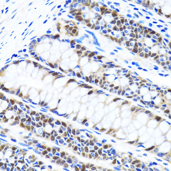 Anti-UHRF1 Antibody (CAB2343)