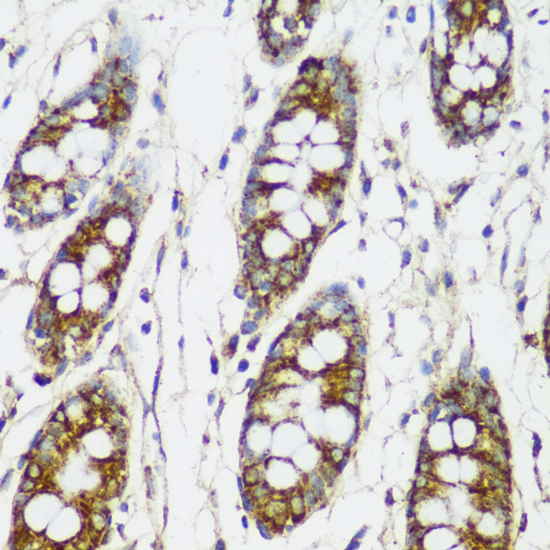 Anti-FNDC4 Antibody (CAB17758)