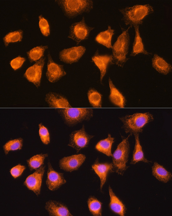 Anti-DSPP Polyclonal Antibody (CAB8413)