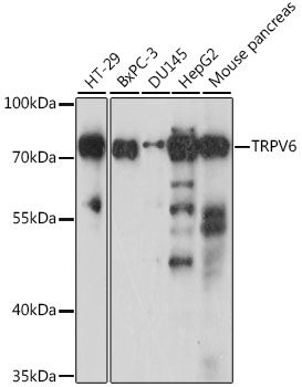 Anti-TRPV6 Antibody (CAB16128)