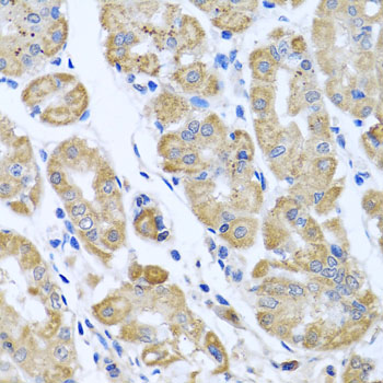 Anti-EIF2S3 Antibody (CAB6581)