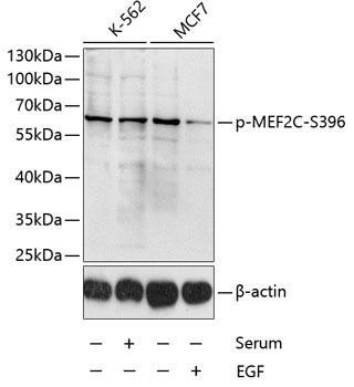 Anti-Phospho-MEF2C-S396 Antibody (CABP0075)