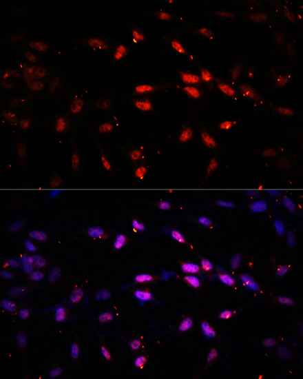 Anti-Kdm6b Antibody (CAB12763)