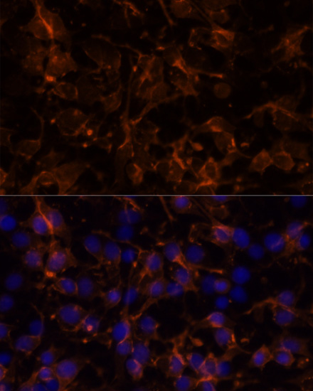 Anti-NCAM1 / CD56 Antibody (CAB7913)