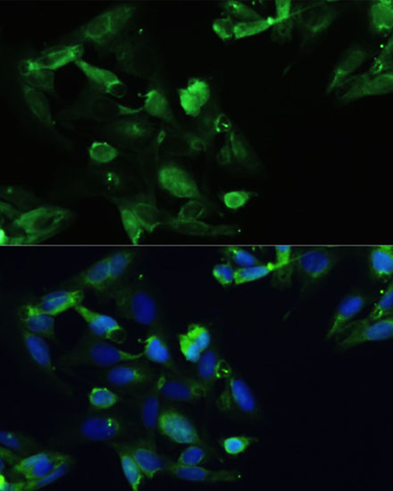 Anti-CXCR5 Antibody (CAB14233)