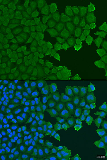 Anti-TCTN2 Antibody (CAB15191)