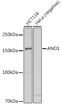 Anti-ANO1 Antibody (CAB10498)