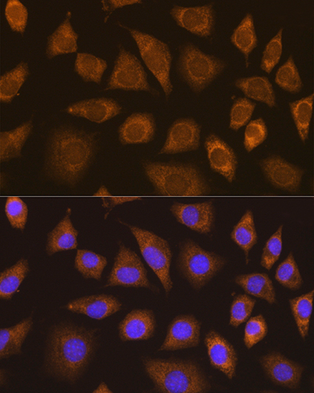 Anti-TRIM25 Antibody (CAB12938)