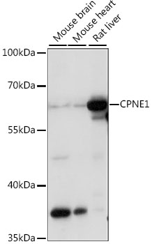 Anti-CPNE1 Antibody (CAB15749)