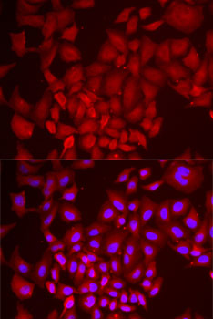 Anti-DCAF7 Antibody (CAB6787)