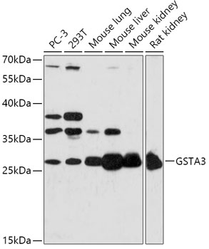 Anti-GSTA3 Antibody (CAB17491)