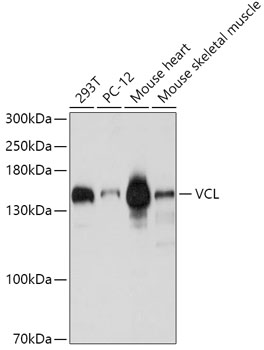 Anti-VCL Antibody (CAB1758)