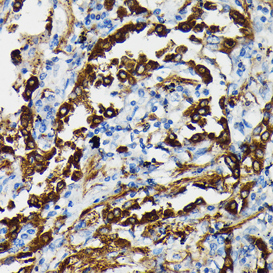 Anti-SFTPA1 Antibody (CAB3133)