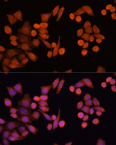 Anti-PLA2G4D Antibody (CAB15224)