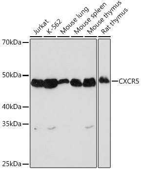 Anti-CXCR5 Antibody (CAB8950)