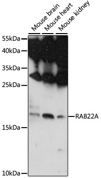 Anti-RAB22A Antibody (CAB15485)