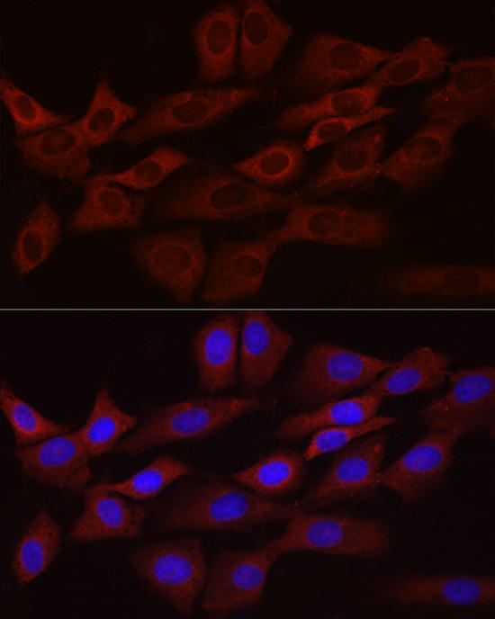 Immunofluorescence analysis of NIH/3T3 cells using Bcl-2 Mouse mAb at dilution of 1:100 (40x lens). Blue: DAPI for nuclear staining.