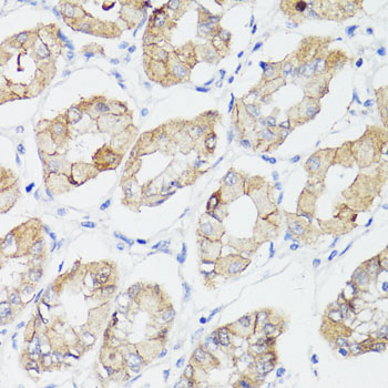 Anti-Beta-Catenin Antibody [KO Validated] (CAB11343)