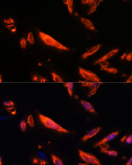 Anti-LRRC7 Antibody (CAB13114)